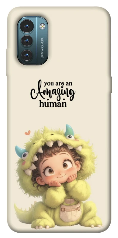 Чехол на Nokia G21 You are amazing фото 1 из 1