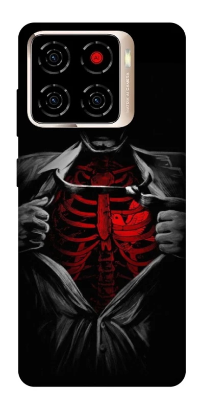 Чехол на ZTE Blade A56 Skeleton Heart фото 1 из 1