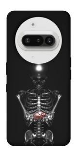 Чехол на Nothing Phone (3a) Скелетон фото 1 из 1