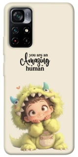 Чехол на Xiaomi Poco M4 Pro 5G You are amazing фото 1 из 1