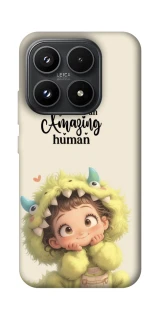 Чехол на Xiaomi 17 You are amazing фото 1 из 1