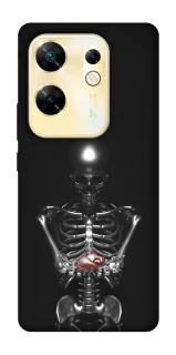Чохол на Infinix Zero 30 4G Скелетон фото 1 з 1