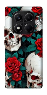 Чехол на Xiaomi Redmi Note 14 Pro 5G skull and rose фото 1 из 1