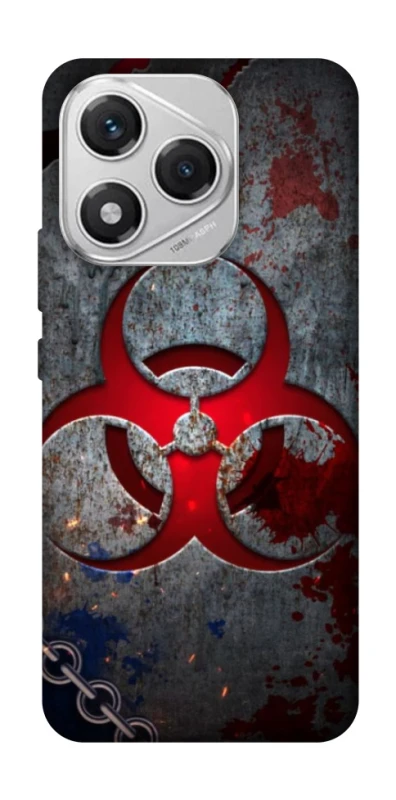 Чехол на Honor 400 Lite Радиация v3 фото 1 из 1