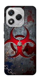 Чехол на Honor 400 Lite Радиация v3 фото 1 из 1