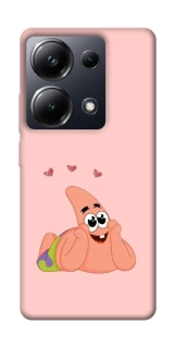 Чохол на Xiaomi Poco M6 Pro 4G Патрік Стар фото 1 з 1