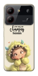 Чехол на ZTE Blade A54 4G You are amazing фото 1 из 1