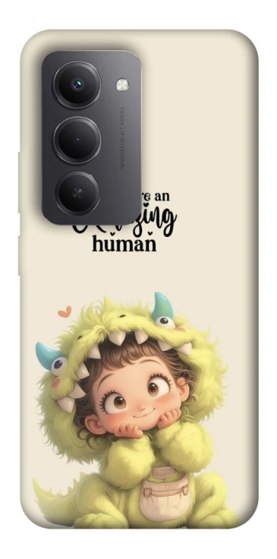 Чохол на Xiaomi Redmi 15 (EU) You are amazing фото 1 з 1