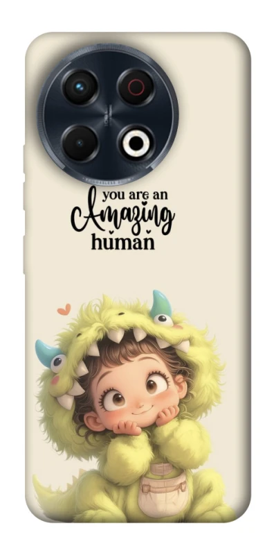 Чохол на TECNO Spark 30 Pro (KL7) You are amazing фото 1 з 1