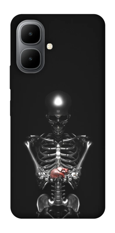 Чехол на Infinix Smart 10 Скелетон фото 1 из 1