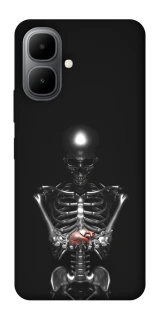 Чохол на Infinix Smart 10 Скелетон фото 1 з 1
