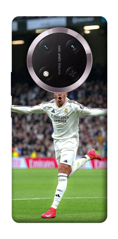 Чехол на Honor X9c Kylian Mbappé V2 фото 1 из 1