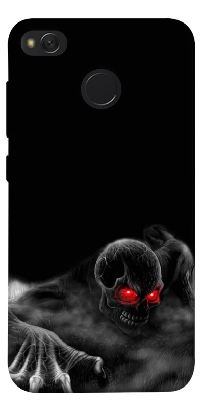 Чохол на Xiaomi Redmi 4X Skeleton v3 фото 1 з 1