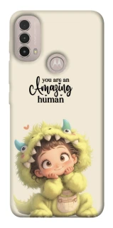 Чехол на Motorola Moto E40 You are amazing фото 1 из 1