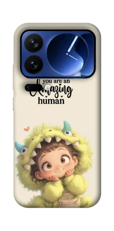 Чохол на Xiaomi 17 Pro You are amazing фото 1 з 1