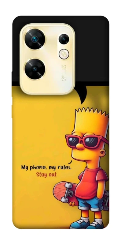 Чохол на Infinix Zero 30 4G Bart фото 1 з 1