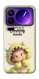 Чехол на Xiaomi 17 Pro Max You are amazing фото 1 из 1