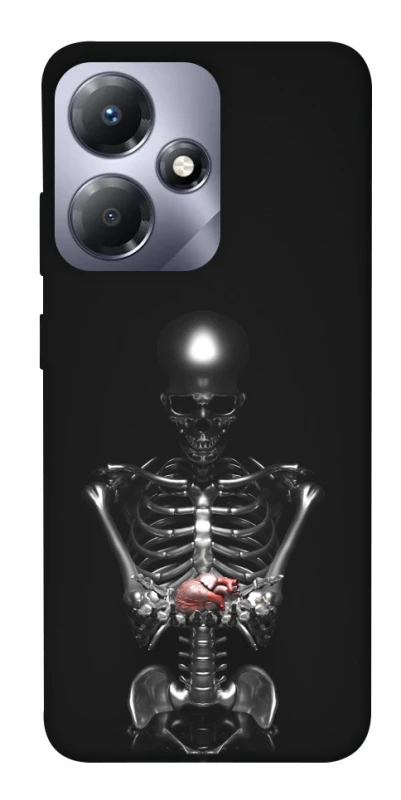 Чохол на Infinix Hot 30 Play Скелетон фото 1 з 1