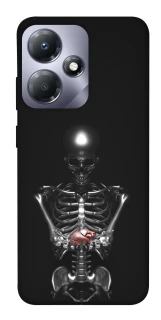 Чохол на Infinix Hot 30i Скелетон фото 1 з 1