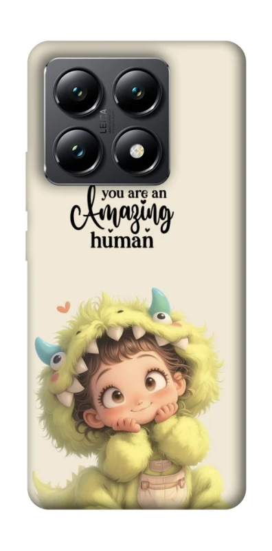 Чохол на Xiaomi 14T You are amazing фото 1 з 1
