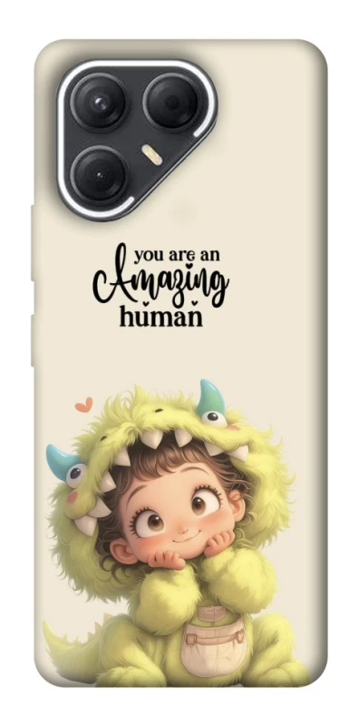 Чохол на TECNO Pova 7 You are amazing фото 1 з 1