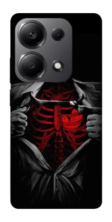 Чохол на Xiaomi Redmi Note 13 Pro 5G Skeleton Heart фото 1 з 1