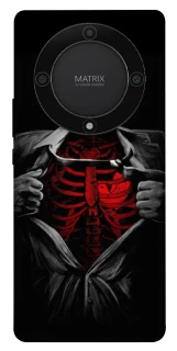 Чохол на Huawei Magic5 Lite Skeleton Heart фото 1 з 1