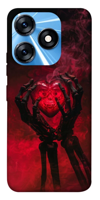 Чохол на TECNO Spark 10 Heart in the hands of a skeleton фото 1 з 1