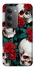 Чохол на Xiaomi Redmi 15 (Global) skull and rose фото 1 з 1