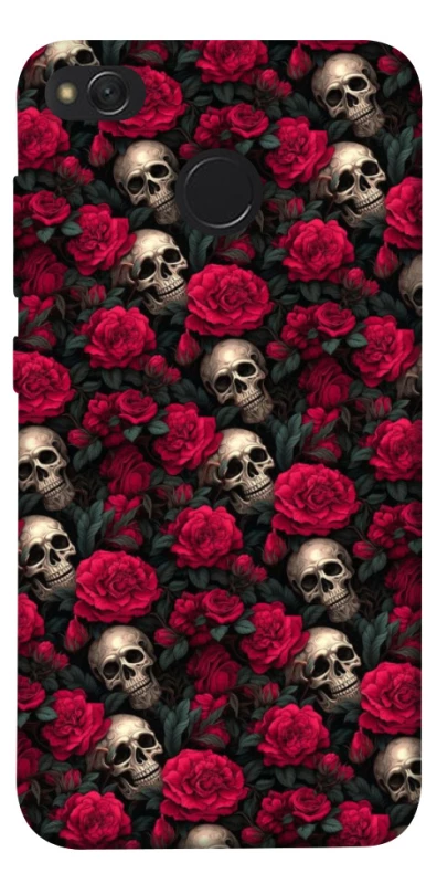 Чохол на Xiaomi Redmi 4X Черепа та рози фото 1 з 1