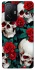 Чохол на Xiaomi 11T / 11T Pro skull and rose фото 1 з 1