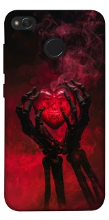 Чехол на Xiaomi Redmi 4X Heart in the hands of a skeleton фото 1 из 1