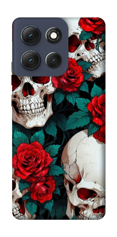 Чехол на Motorola Moto G86 skull and rose фото 1 из 1