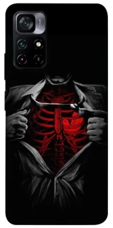 Чехол на Xiaomi Poco M4 Pro 5G Skeleton Heart фото 1 из 1