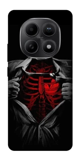 Чохол на Xiaomi Redmi Note 15 5G Skeleton Heart фото 1 з 1