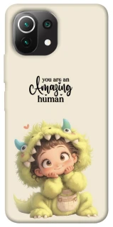 Чехол на Xiaomi Mi 11 Lite You are amazing фото 1 из 1