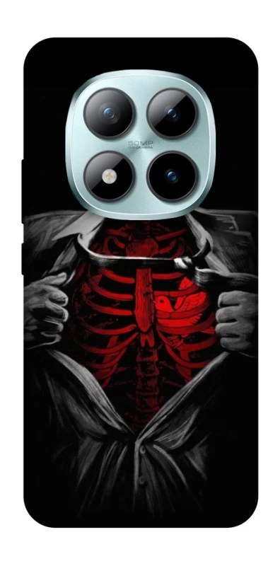 Чохол на Xiaomi Redmi Note 15 Pro+ 5G Skeleton Heart фото 1 з 1