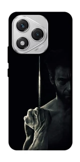 Чохол на Honor 400 Lite Logan фото 1 з 1