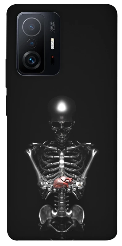 Чехол на Xiaomi 11T / 11T Pro Скелетон фото 1 из 1