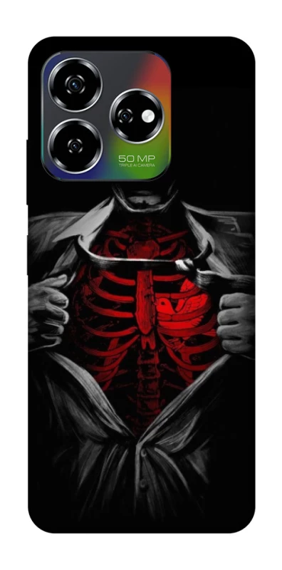 Чохол на ZTE Nubia V60 Skeleton Heart фото 1 з 1