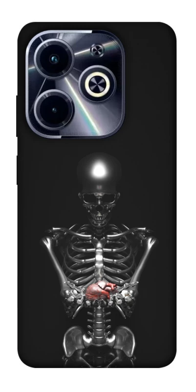 Чехол на Infinix Hot 40i Скелетон фото 1 из 1