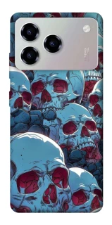 Чехол на ZTE Blade A76 Skulls v2 фото 1 из 1