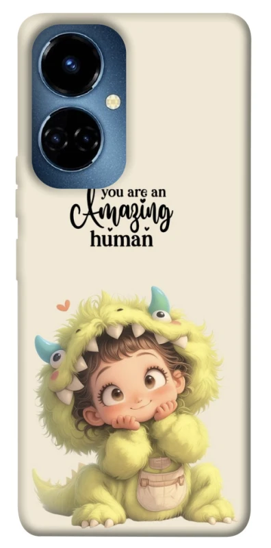 Чохол на TECNO Camon 19 Pro You are amazing фото 1 з 1