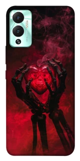 Чехол на Infinix Hot 12 Play Heart in the hands of a skeleton фото 1 из 1