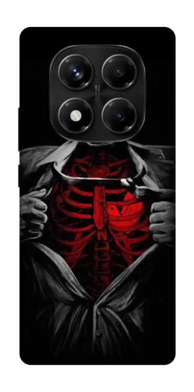 Чохол на Xiaomi Redmi Note 14 Pro 5G Skeleton Heart фото 1 з 1