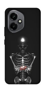 Чохол на Honor 400 Скелетон фото 1 з 1