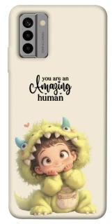 Чехол на Nokia G22 You are amazing фото 1 из 1