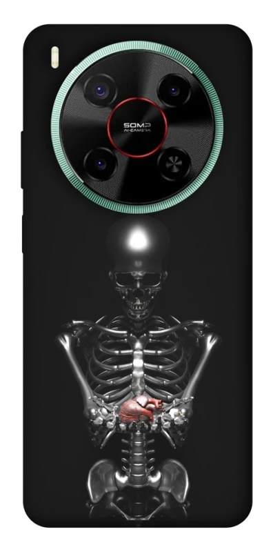 Чохол на ZTE Nubia V70 Max Скелетон фото 1 з 1