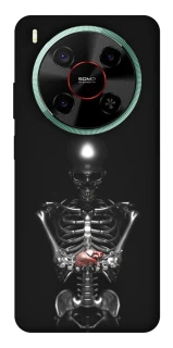 Чохол на ZTE Nubia V70 Max Скелетон фото 1 з 1