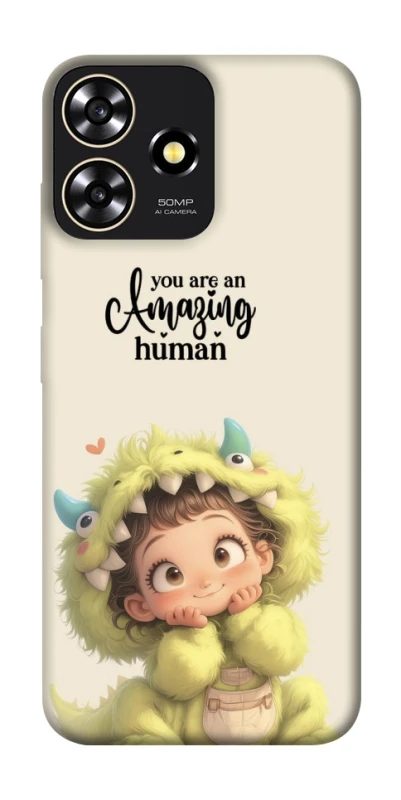 Чехол на ZTE Blade A73 4G You are amazing фото 1 из 1